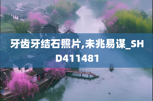 牙齿牙结石照片,未兆易谋_SHD411481